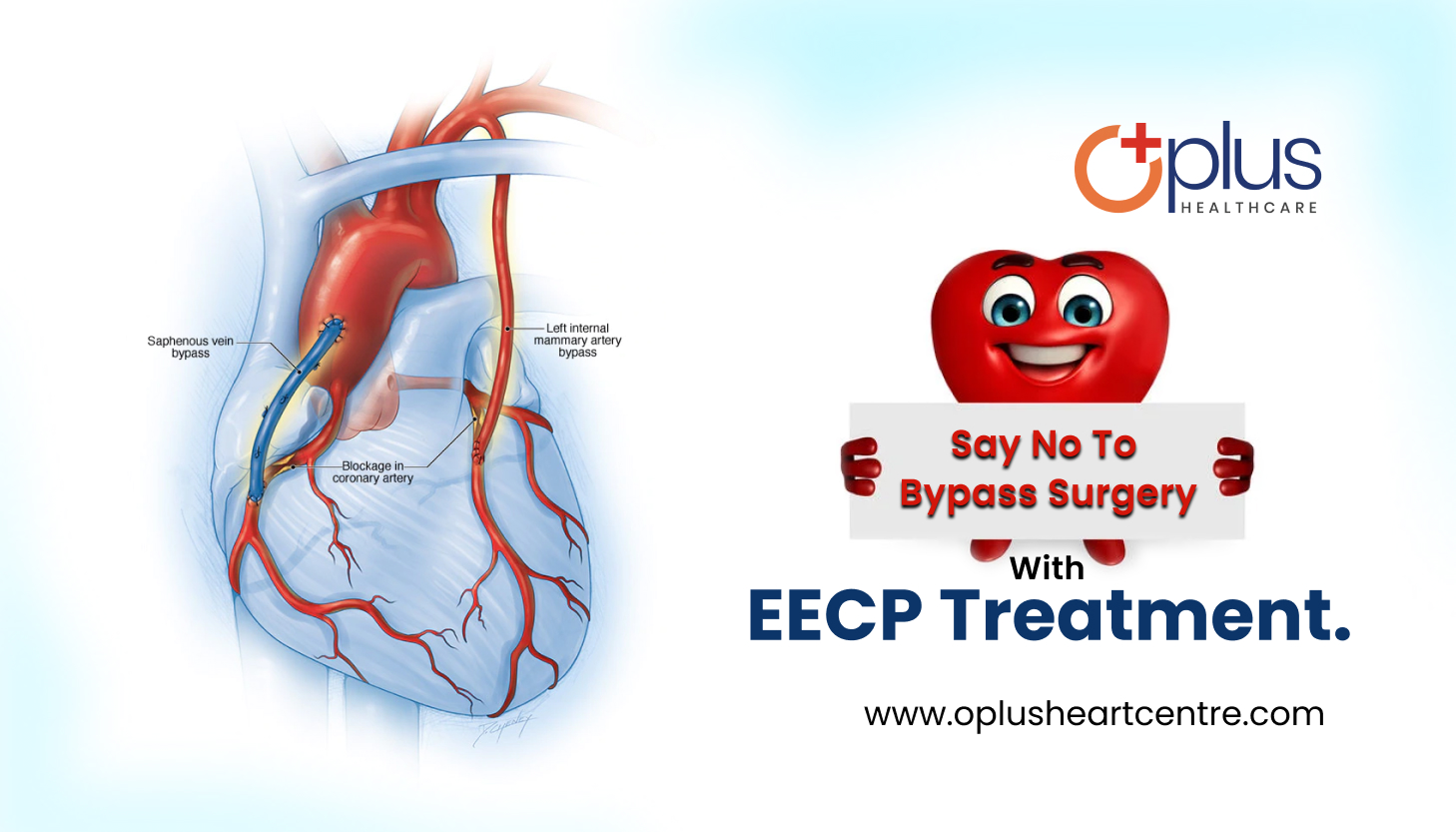 Say No To Bypass Surgery With EECP Treatment Oplus