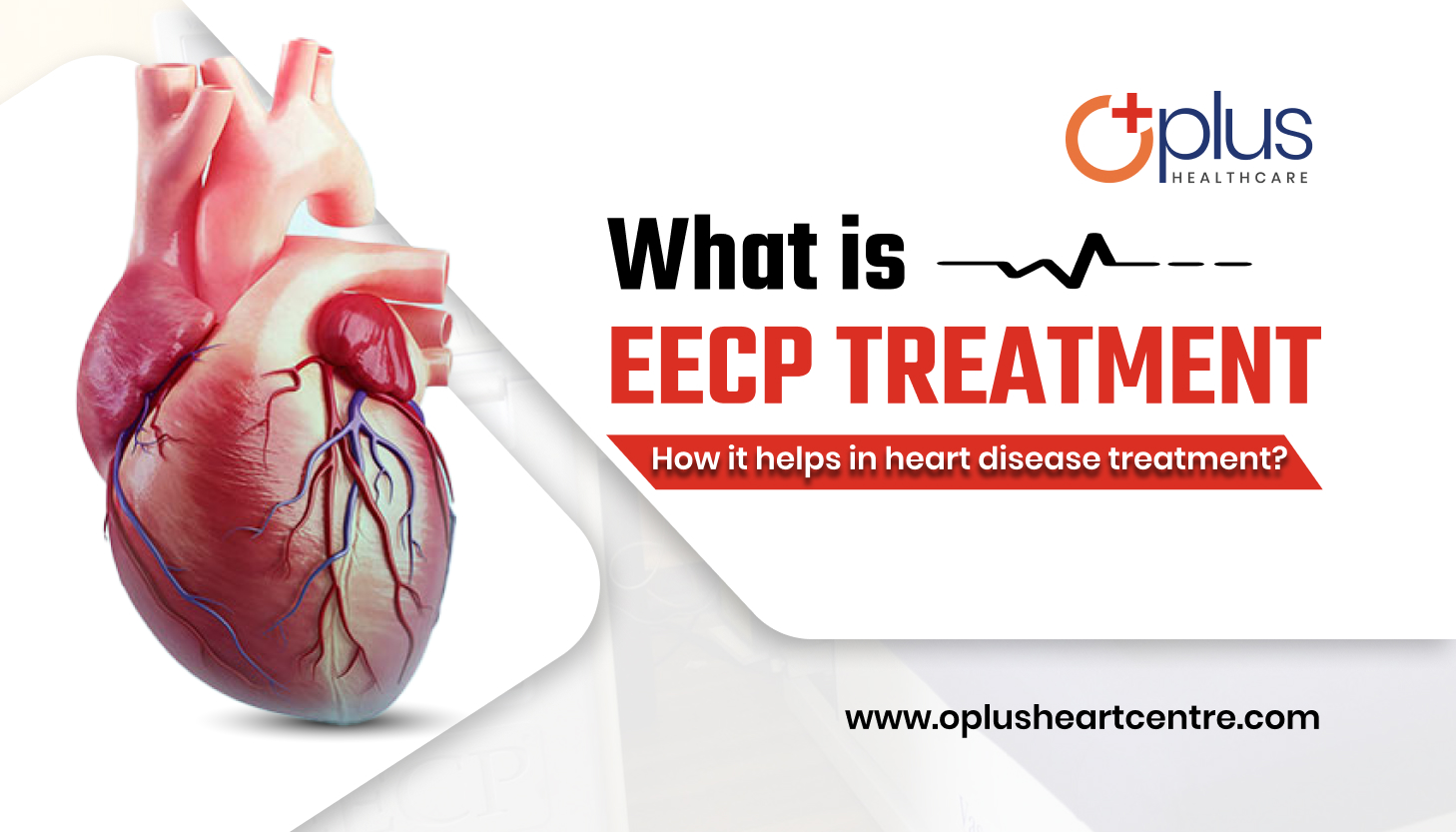What is EECP treatment, how it helps in heart disease treatment?