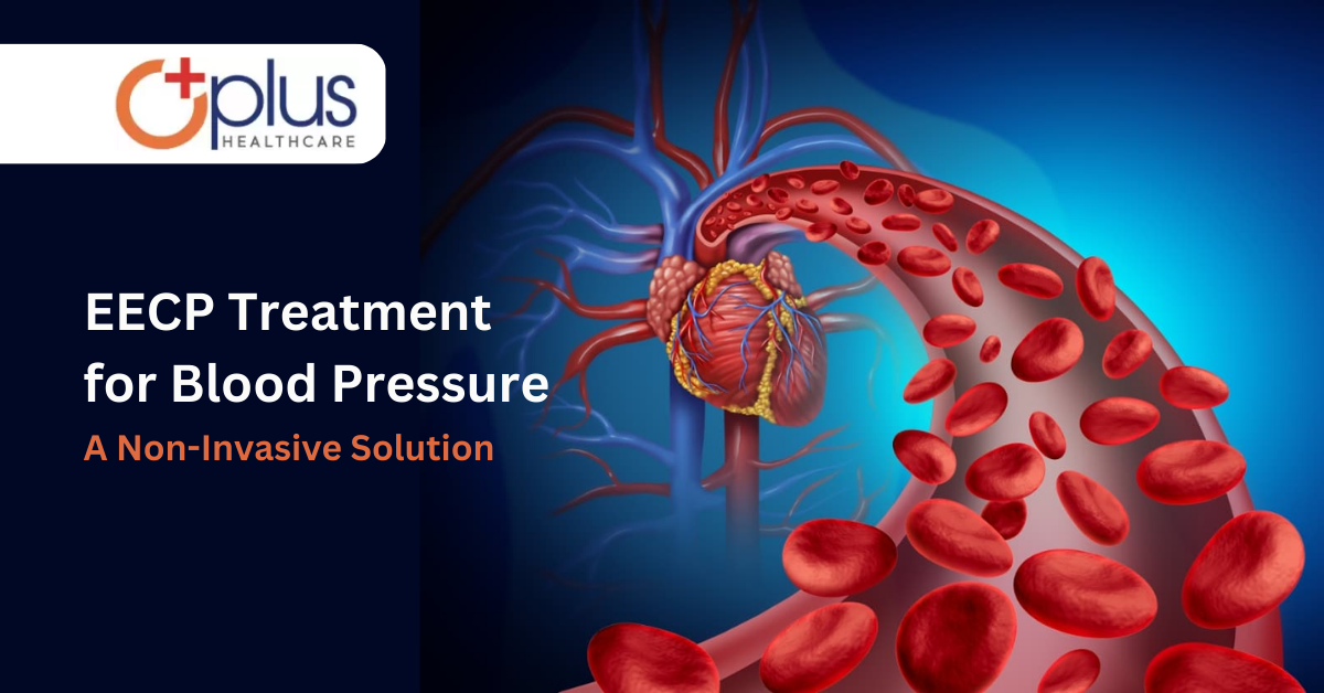 EECP Treatment For Blood Pressure - A Non-Invasive Solution