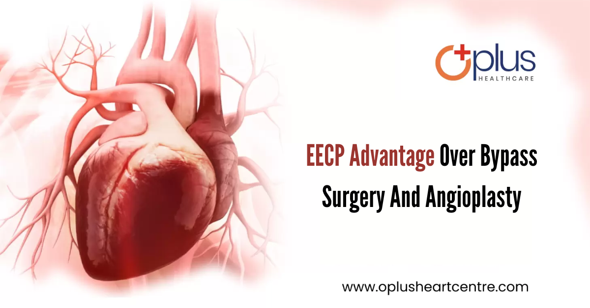 EECP Advantage Over Bypass Surgery And Angioplasty - OPLUS