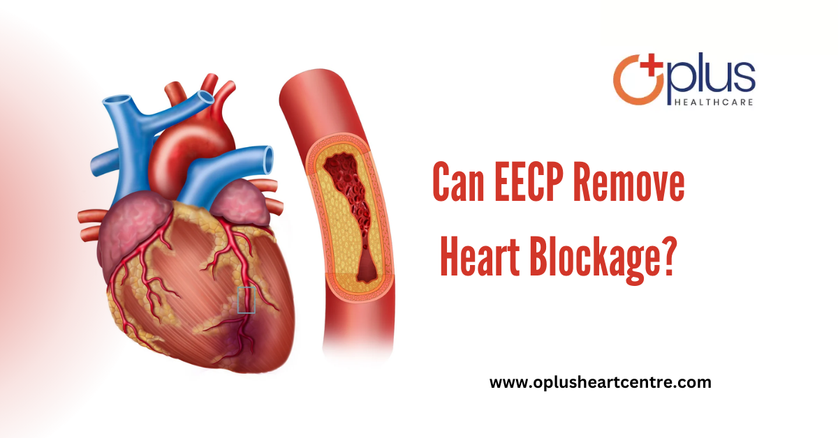 Can EECP Remove Heart Blockage?