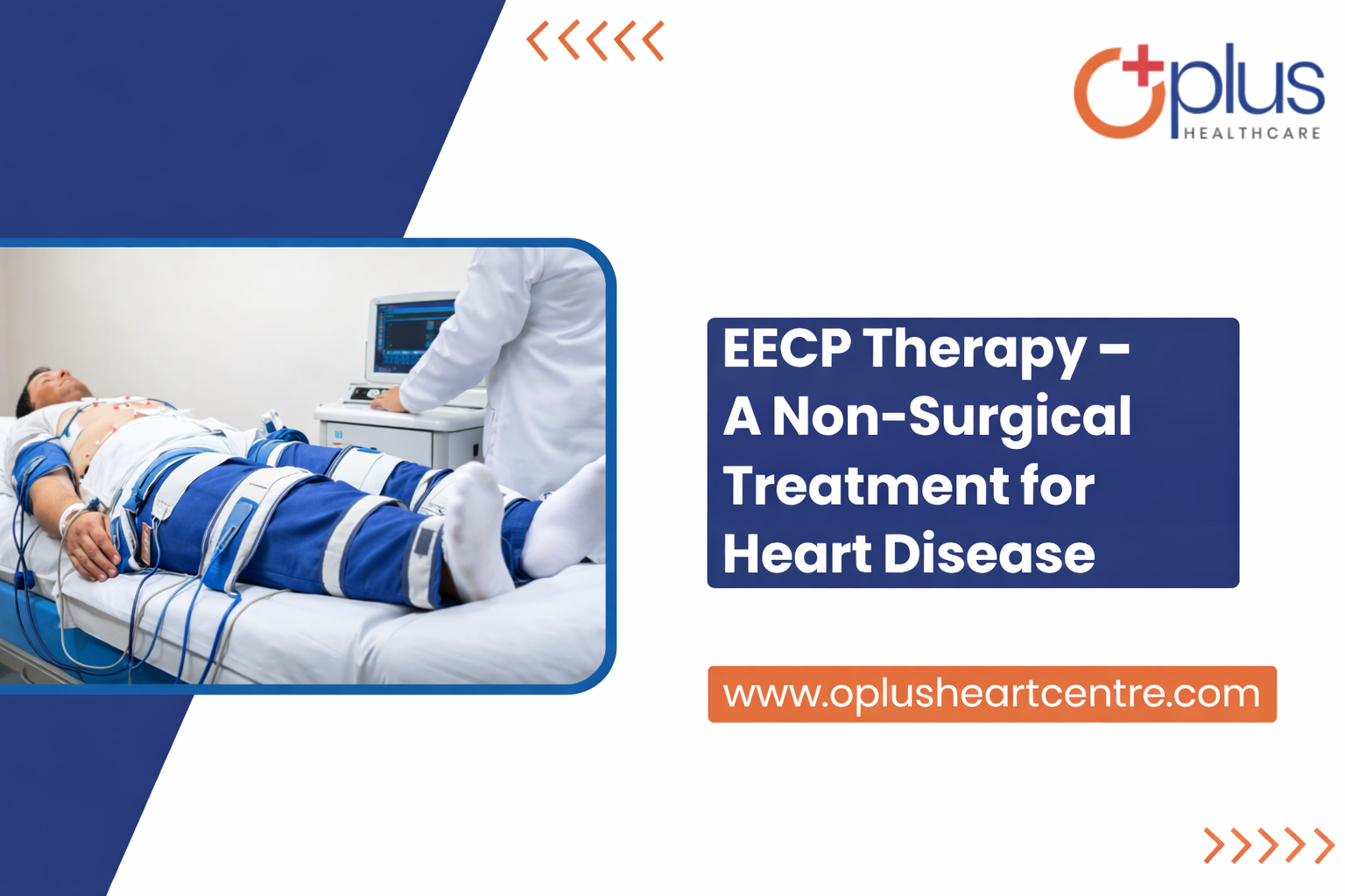 EECP Therapy – A Non-Surgical Treatment for Heart Disease