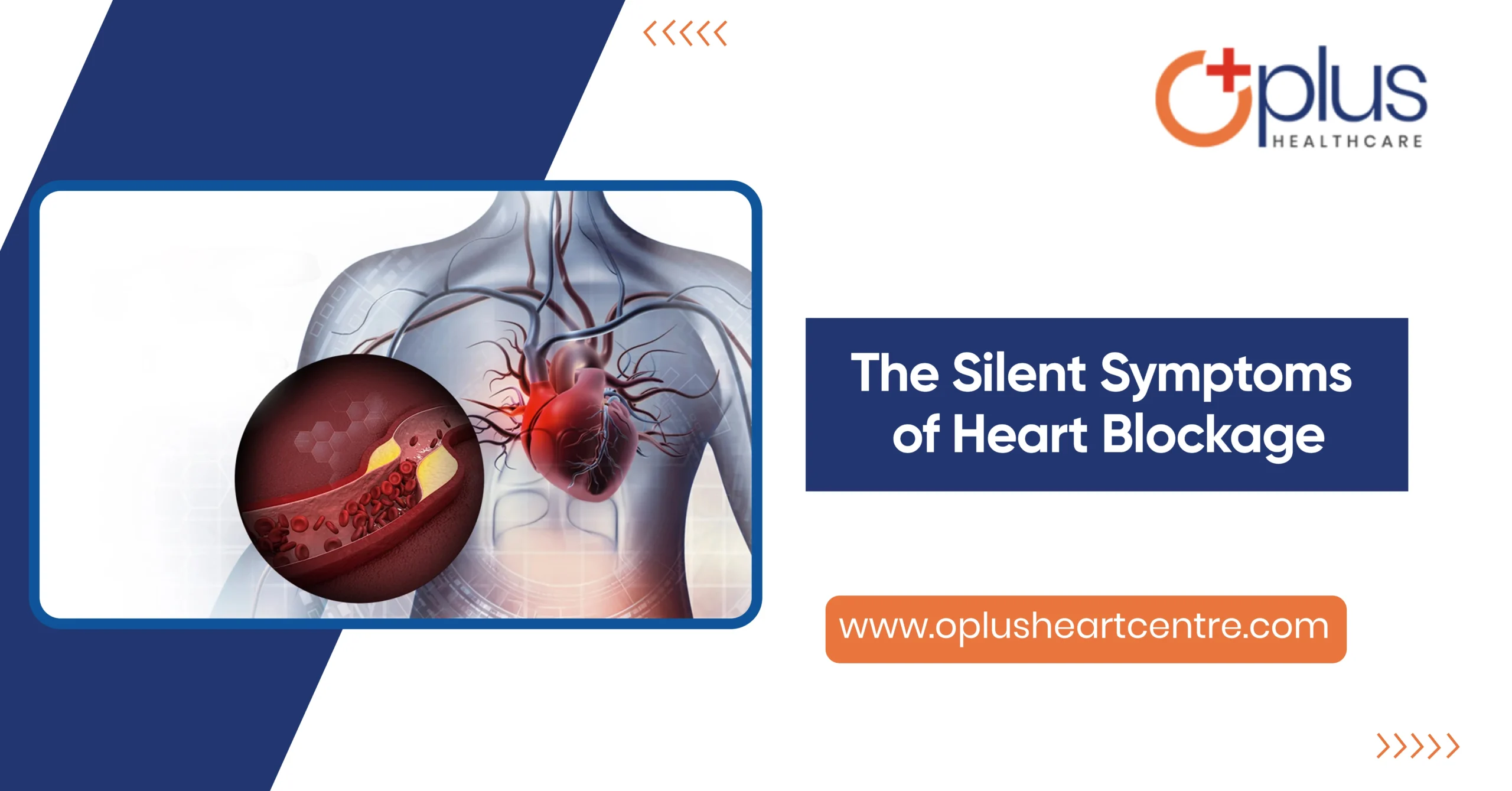 The Silent Symptoms of Heart Blockage
